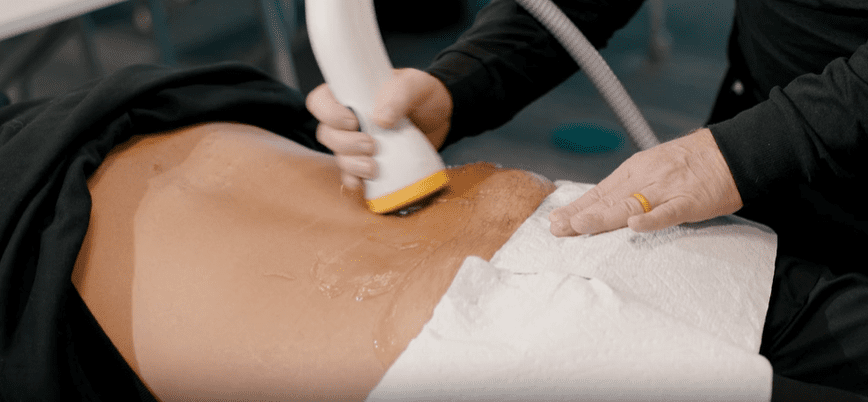 A person is using an instrument to treat the skin.