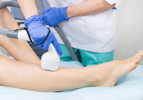 The process of laser depilation of female limbs in the beauty salon.